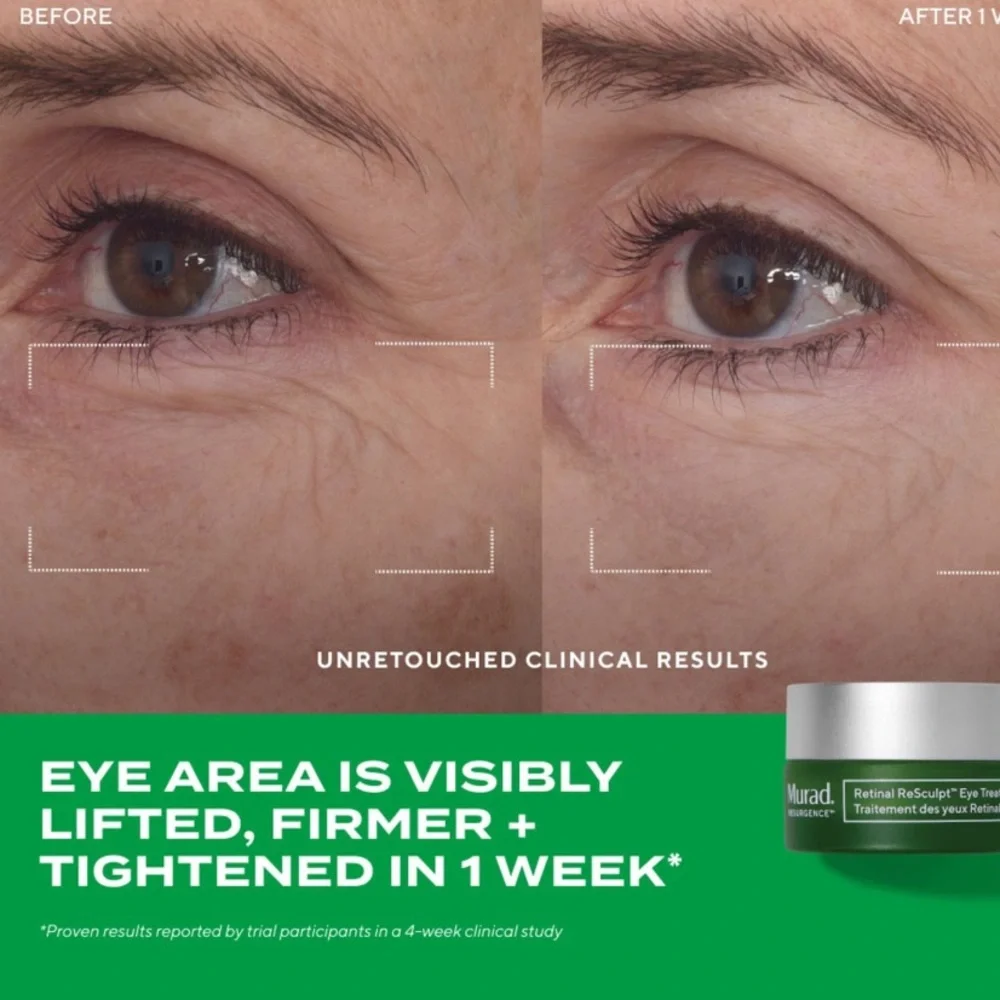 NWT Murad Retinal ReSculpt Eye Treatment - 15 ml